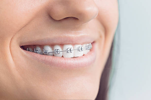Best Invisalign and Clear Aligners  in Cherry Valley, IL